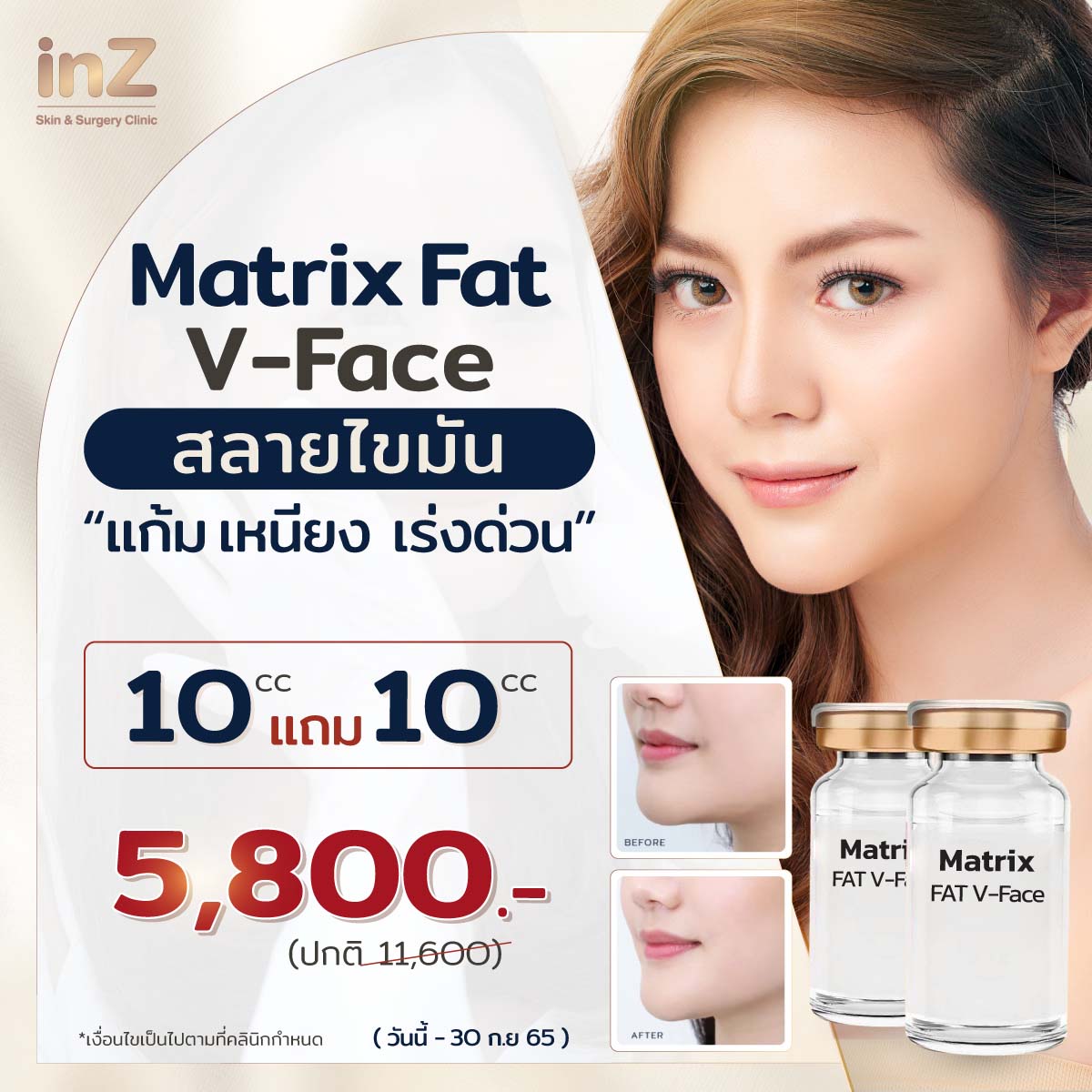 Matrix Fat VFace inZ Clinic