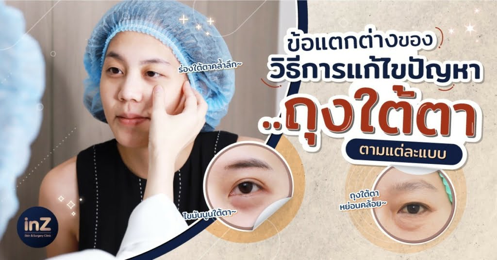 ข้อแตกต่างของวิธีการแก้ไขปัญหาถุงใต้ตาแต่ละแบบ
