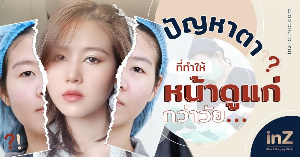 ปัญหาตาที่ทำให้หน้าดูแก่กว่าวัย